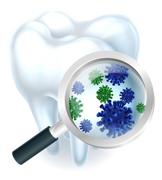 Plaque-Bakterien auf der Zahnoberfläche